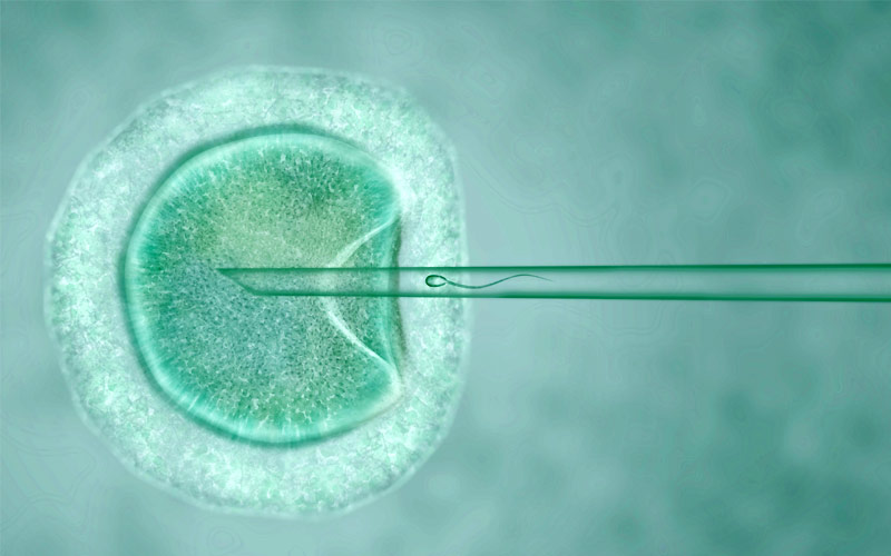 IVF - In-Vitro Fertilization - Process of Intracytoplasmic Sperm Injection
